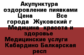 Акупунктура, оздоровление пиявками › Цена ­ 3 000 - Все города, Жуковский г. Медицина, красота и здоровье » Медицинские услуги   . Кабардино-Балкарская респ.